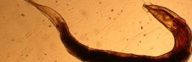 human body parasite worm