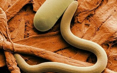 The causes of worms in humans