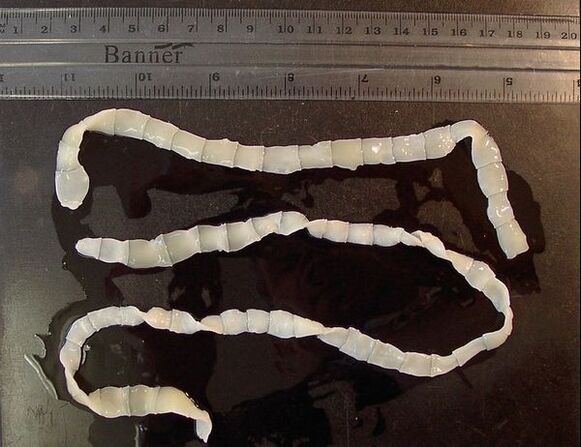 human body wide tapeworm