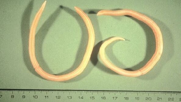 Roundworms are worms that manifest themselves with fatigue and coughing.