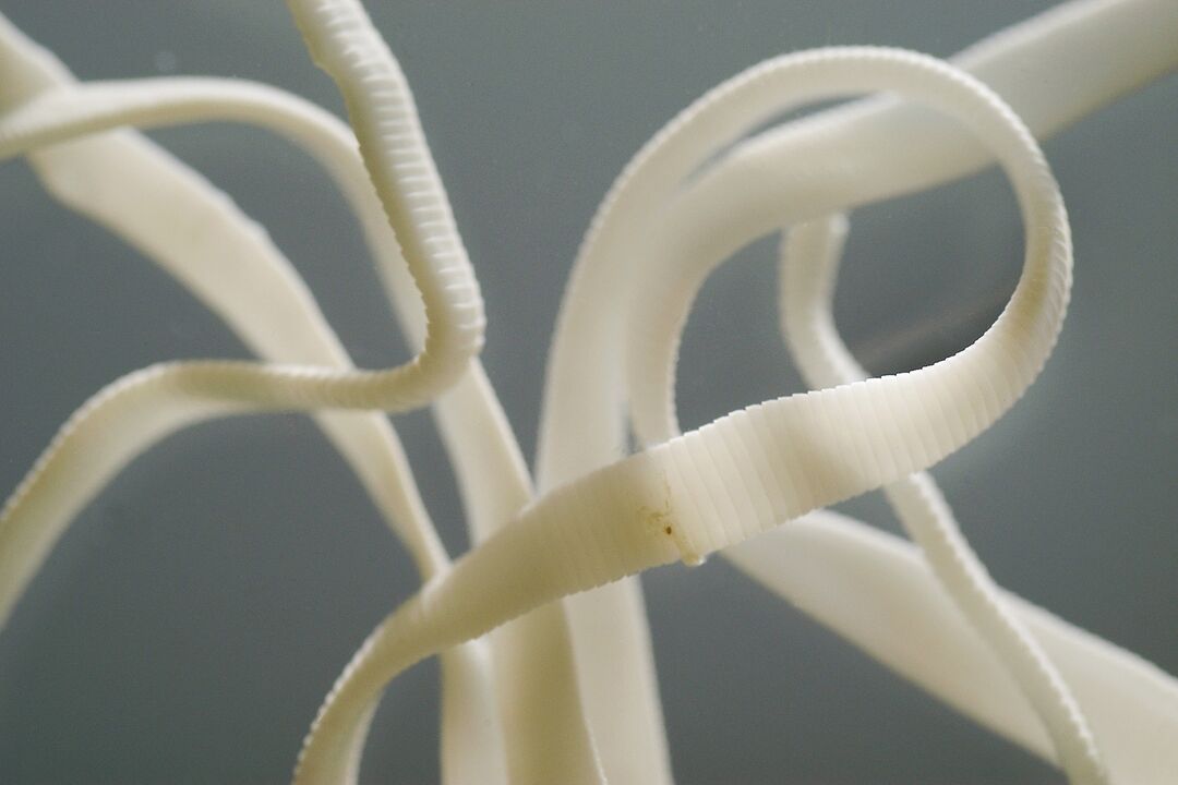 human roundworm