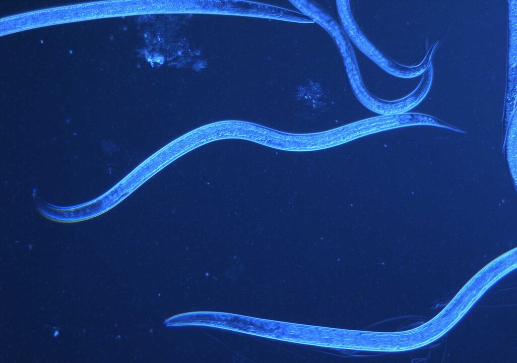 human whipworm