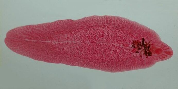 worm fluke in humans
