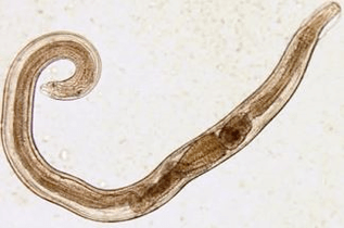 pinworms in human body