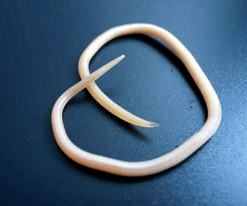 what do roundworms look like